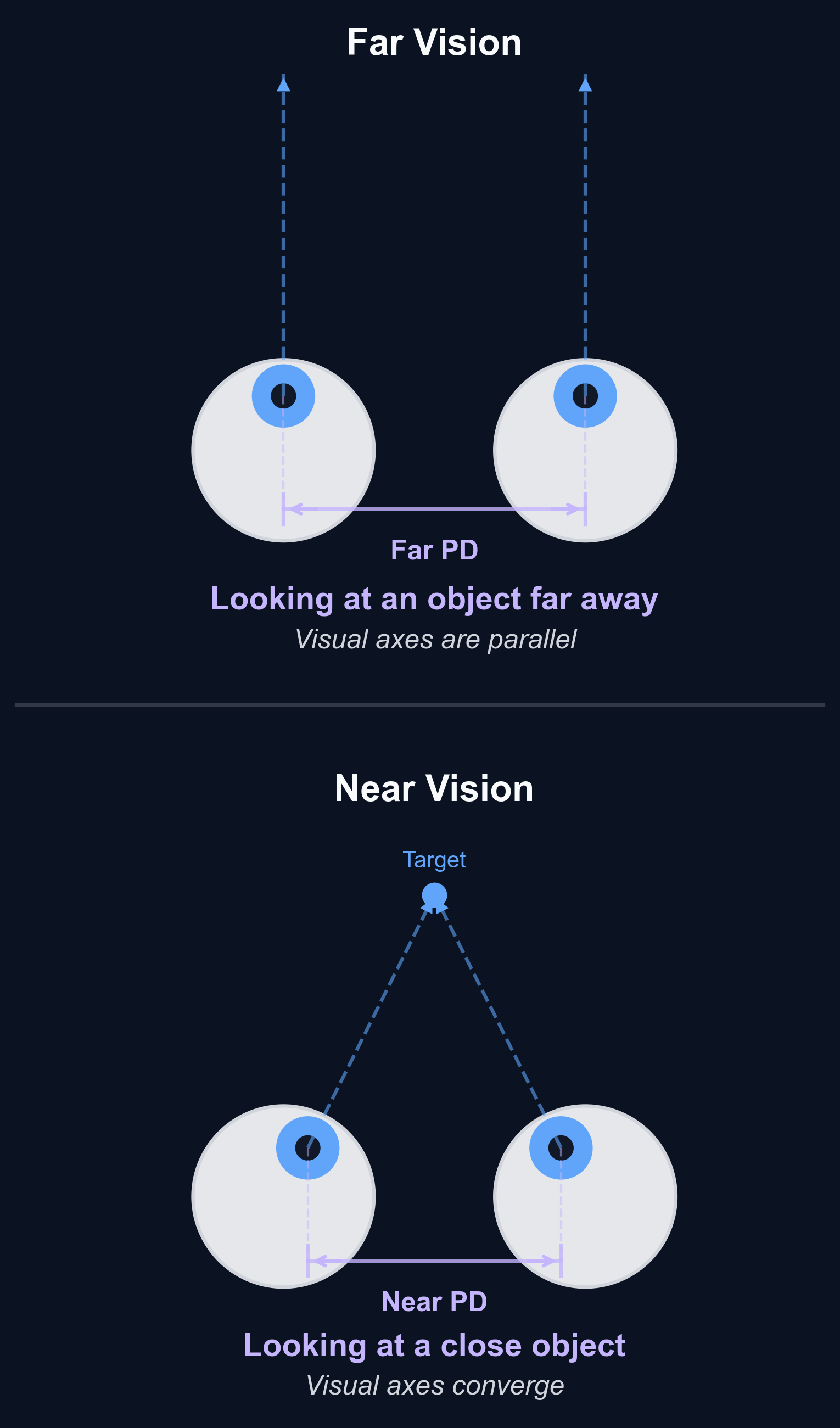 Diagrama que mostra como os olhos rodam para dentro (convergem) quando se focam num objeto próximo, resultando numa distância pupilar mais pequena em comparação com a visão ao longe