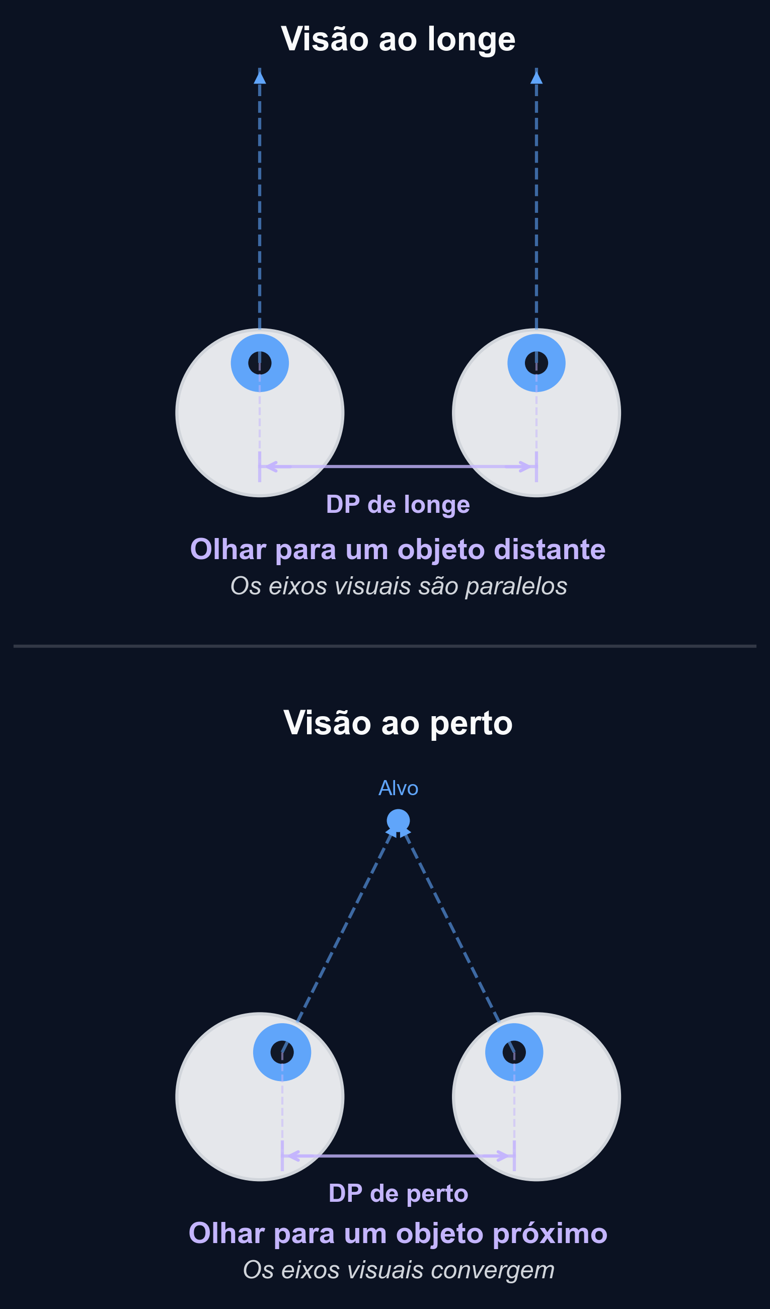 Diagrama que mostra como os olhos rodam para dentro (convergem) quando se focam num objeto próximo, resultando numa distância pupilar mais pequena em comparação com a visão ao longe